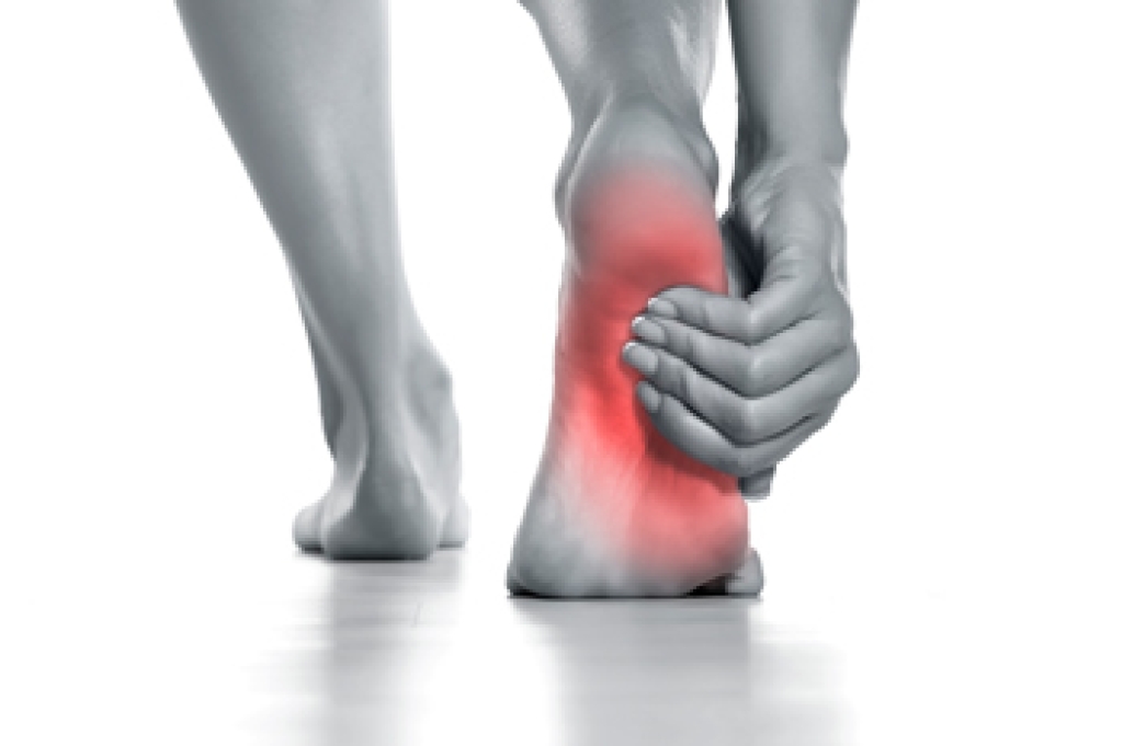 Pain That Develops in the Arch of the Foot