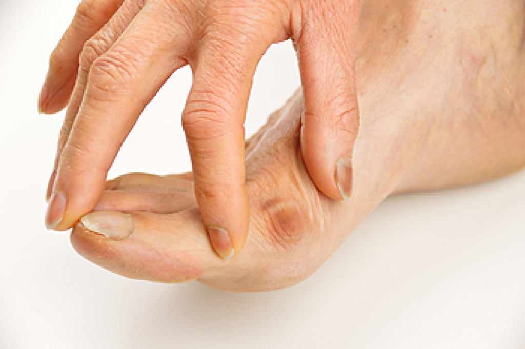 Bunion Symptoms and How a Podiatrist Can Help