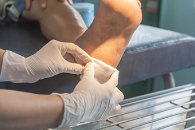 Caring for Heel Pressure Ulcers Before They Worsen